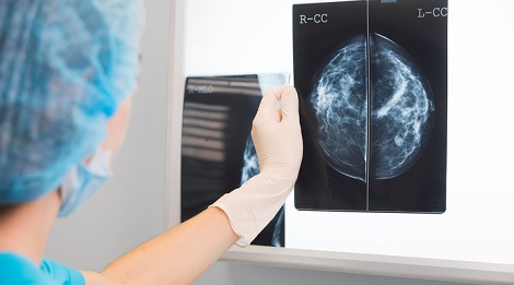piedmont hospital breast center Wet ass fuck
